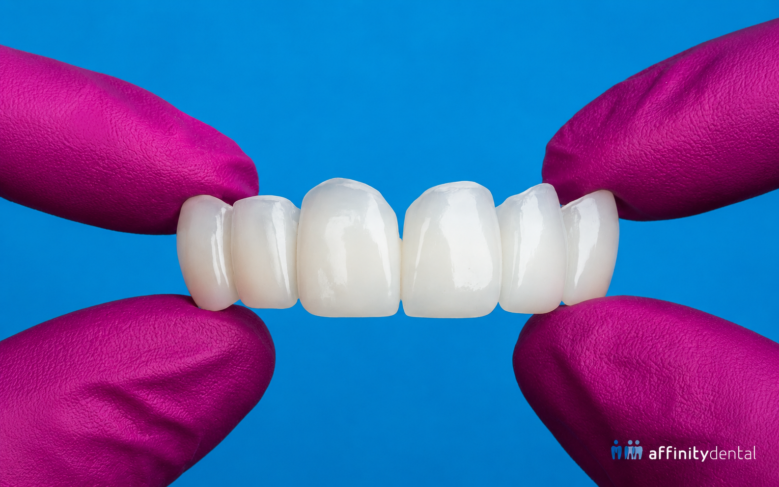Full mouth rehabilitation – complete oral restoration Hyderabad