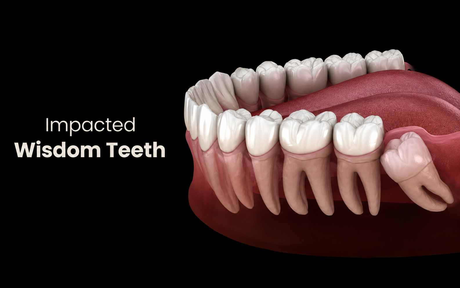 Preventive dental care and hygiene Narsingi Hyderabad