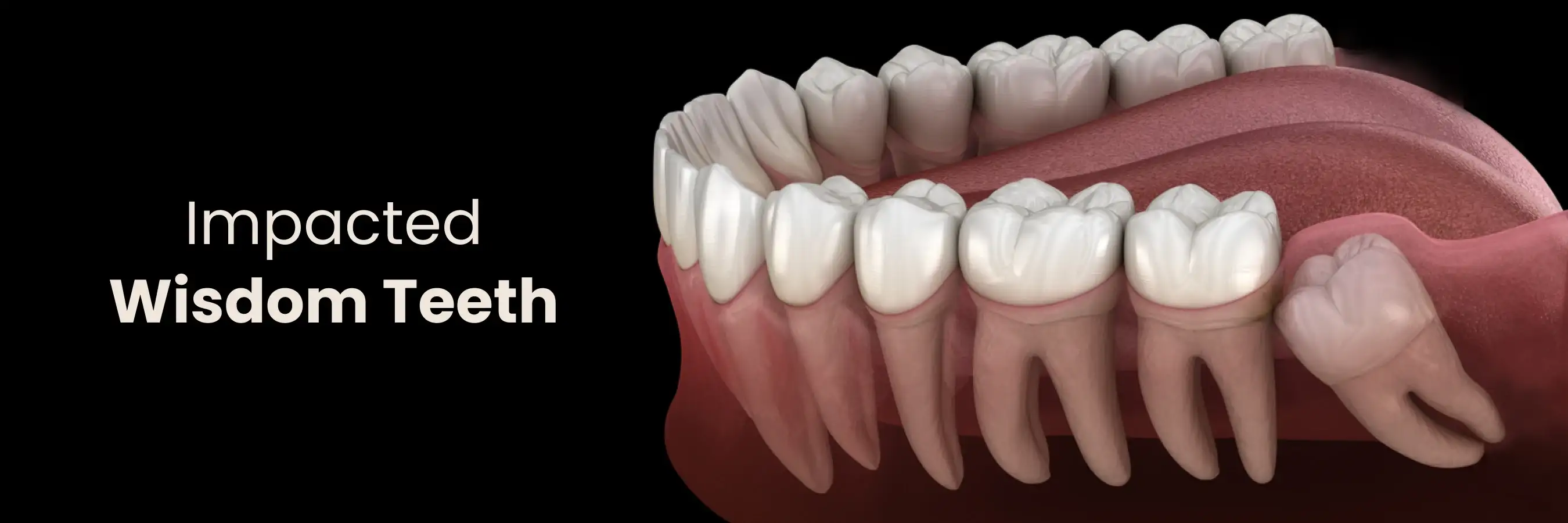 Smile makeover consultation