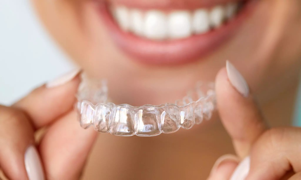 Clear aligner with beautiful smile