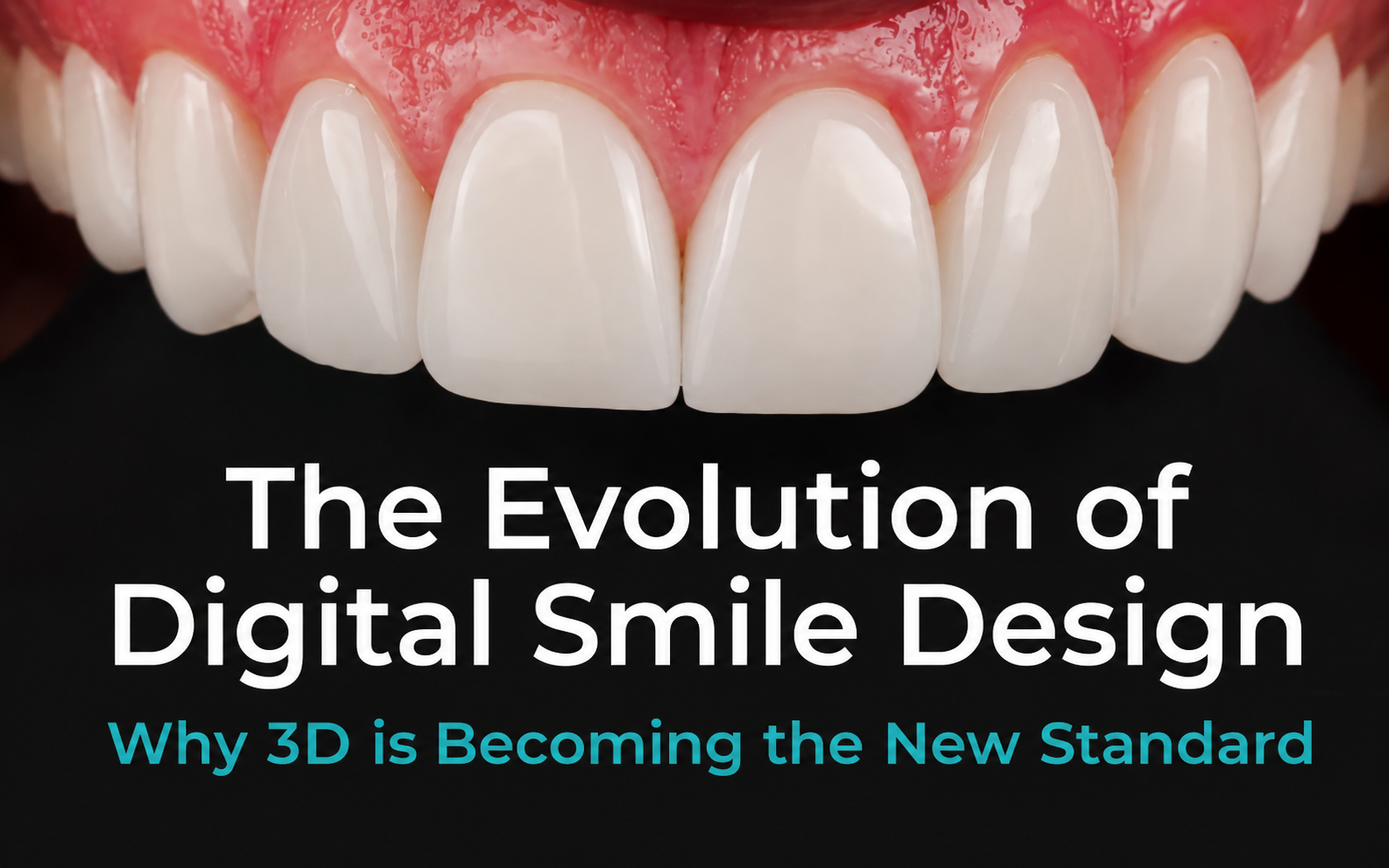 Smile designing and makeover – veneers Hyderabad