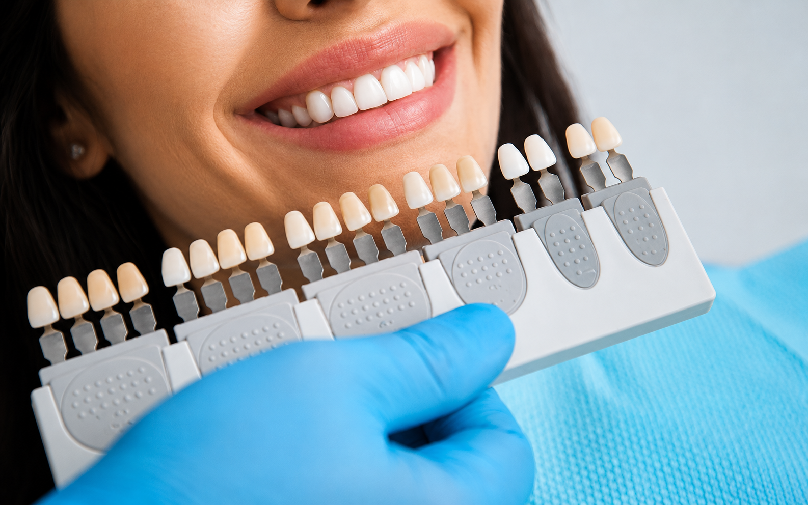 Teeth whitening cosmetic dentistry Narsingi Hyderabad